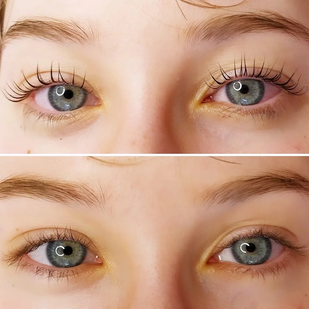 Beide Augen vorher und nachher nach einem Wimpernlifting